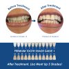 Whiter Image - Products - Whiter Image Nano-Bio Activation Whitening Toothpaste 06