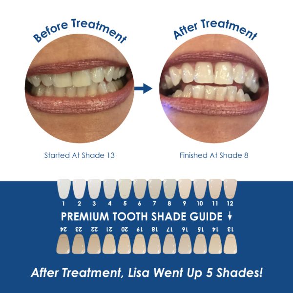Whiter Image - Products - Whiter Image Nano-Bio Activation Whitening Toothpaste 06