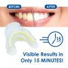 Whiter Image - Products - White Blitz Premium Prefilled Whitening Kit 03