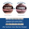 Whiter Image - Products - Whiter Image ToGo Whitening Pen 07
