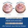 Whiter Image - Products - Whiter Image Remi Paste 07