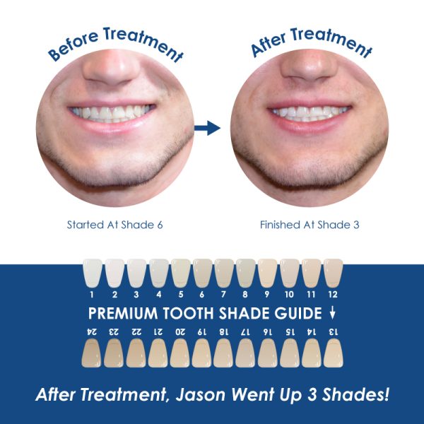 Whiter Image - Products - Whiter Image Remi Paste 07