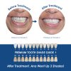 Whiter Image - Products - Mini Customized Dental Whitening Pens 07