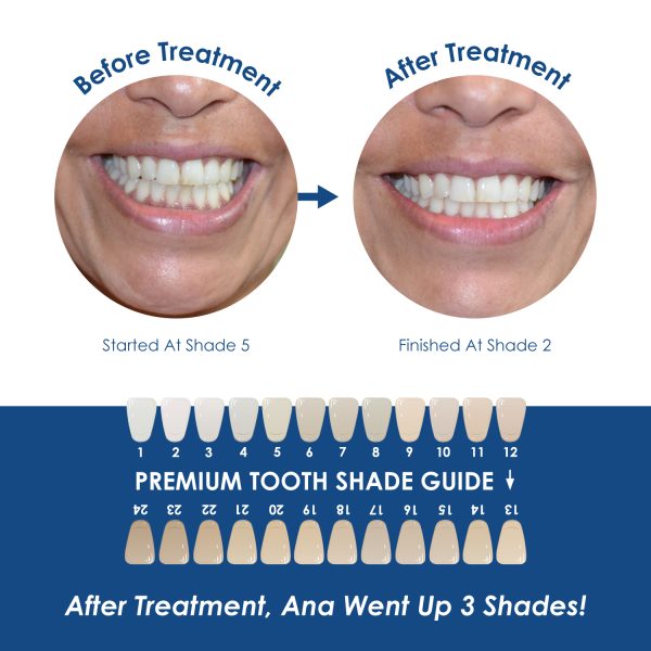 Whiter Image - Products - Mini Customized Dental Whitening Pens 07