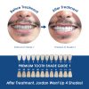 Whiter Image - Products - Whiter Image 12% HP Deluxe Home Edition Whitening Kit 07