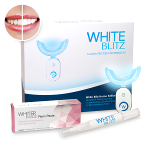 One Year White Blitz Illuminating Teeth Whitening Kit