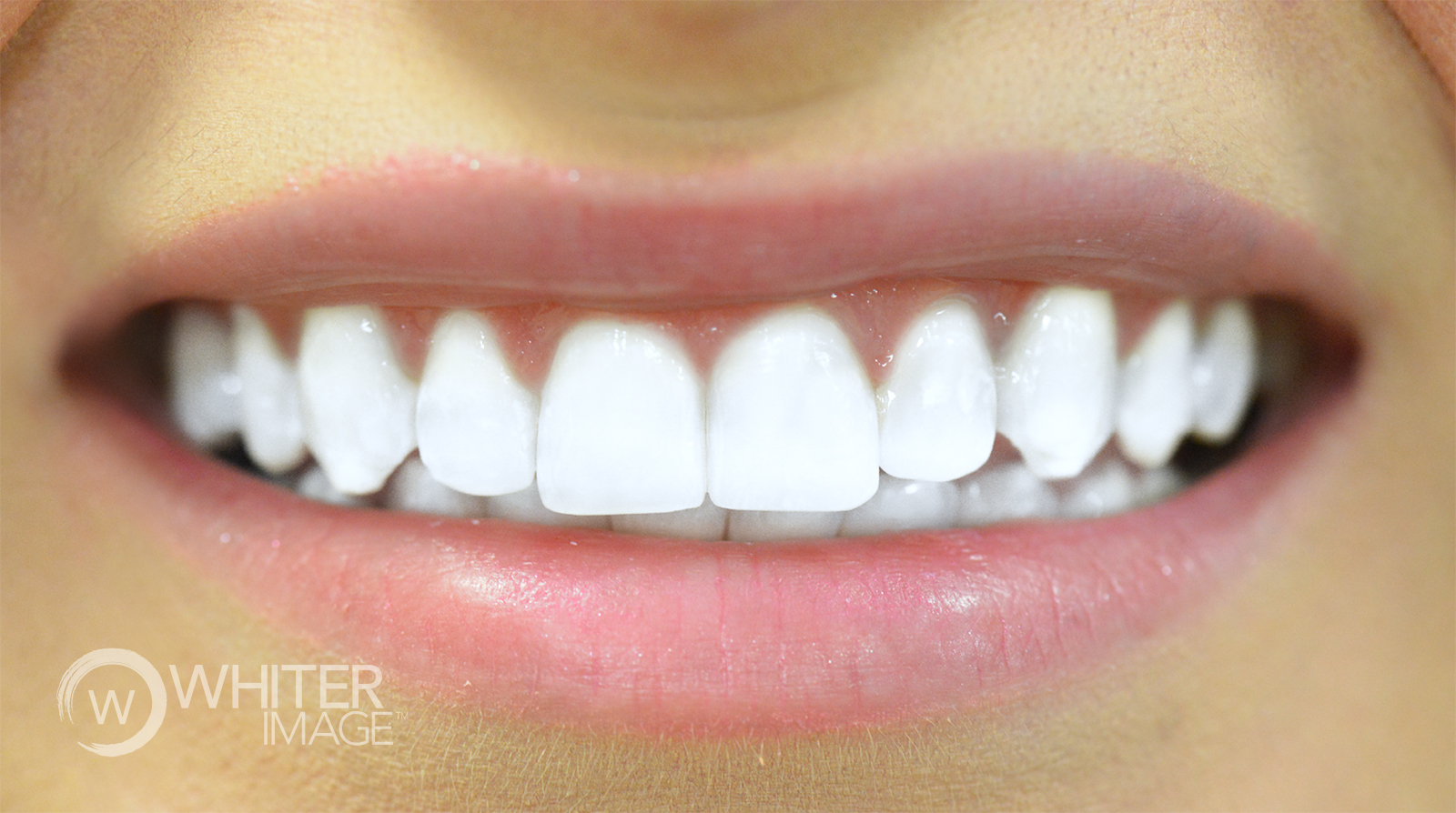 Whiter Image - After Image