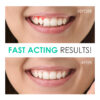 Gingi-Pak - Perio Armor - Oral Cleansing Gel - 04