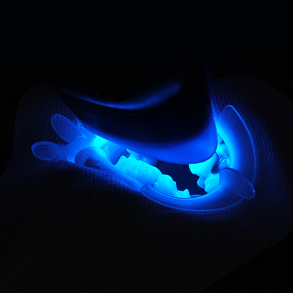 Whiter Image - Category - In-Office Whitening - 01